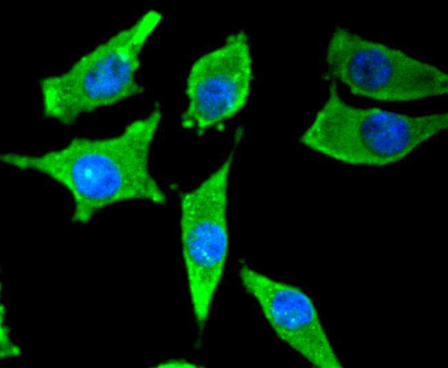 Tyrosine Hydroxylase Antibody in Immunocytochemistry (ICC/IF)