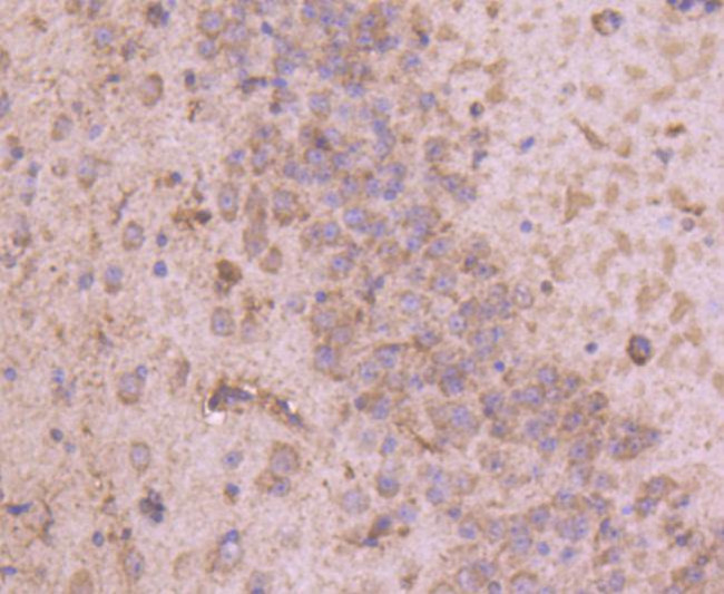 Tyrosine Hydroxylase Antibody in Immunohistochemistry (Paraffin) (IHC (P))