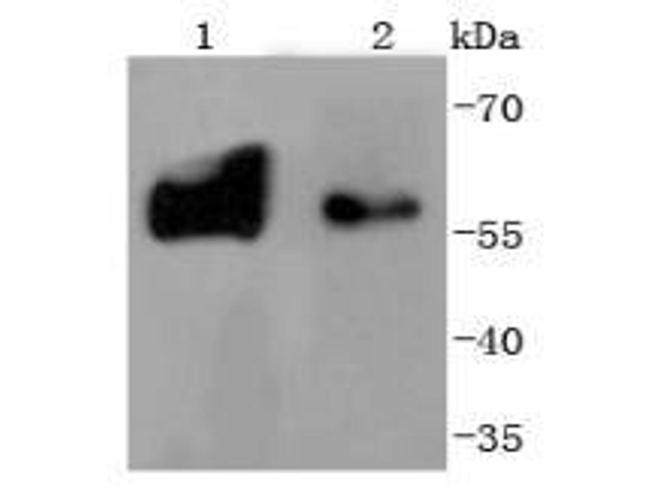 Tyrosine Hydroxylase Antibody in Western Blot (WB)