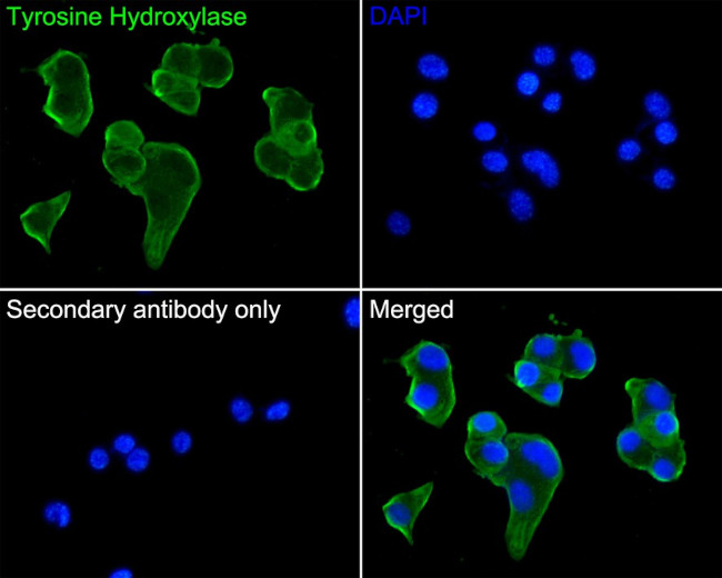 Tyrosine Hydroxylase Antibody in Immunocytochemistry (ICC/IF)