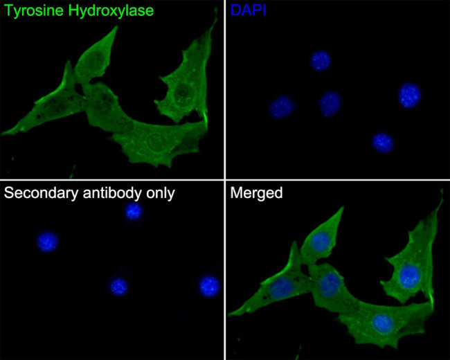 Tyrosine Hydroxylase Antibody in Immunocytochemistry (ICC/IF)