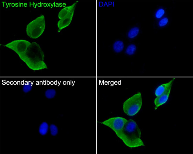 Tyrosine Hydroxylase Antibody in Immunocytochemistry (ICC/IF)