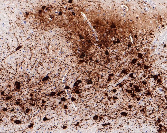 Tyrosine Hydroxylase Antibody in Immunohistochemistry (Paraffin) (IHC (P))