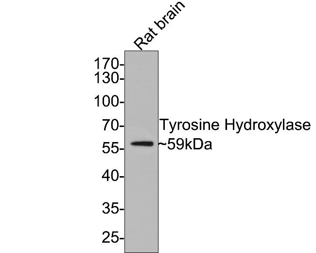 Tyrosine Hydroxylase Antibody in Western Blot (WB)