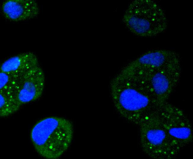 STAT6 Antibody in Immunocytochemistry (ICC/IF)