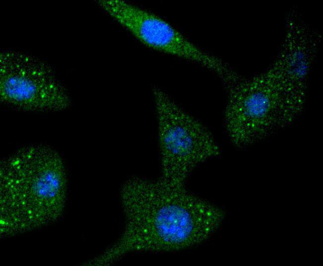 STAT6 Antibody in Immunocytochemistry (ICC/IF)