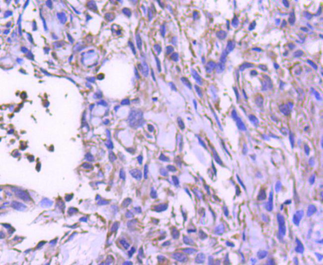 STAT6 Antibody in Immunohistochemistry (Paraffin) (IHC (P))