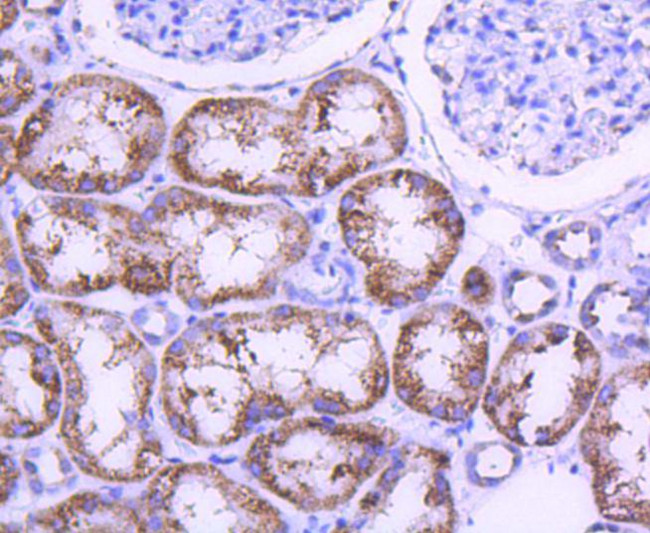 STAT6 Antibody in Immunohistochemistry (Paraffin) (IHC (P))