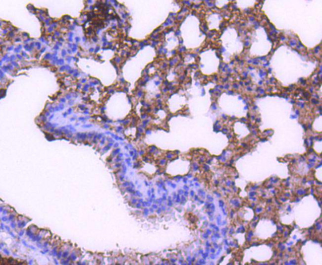 STAT6 Antibody in Immunohistochemistry (Paraffin) (IHC (P))