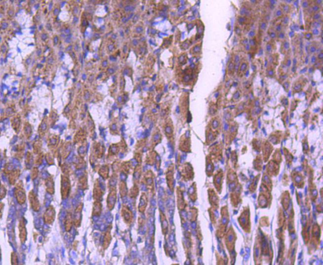 STAT6 Antibody in Immunohistochemistry (Paraffin) (IHC (P))