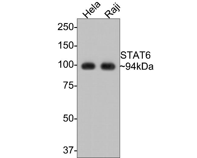 STAT6 Antibody in Western Blot (WB)