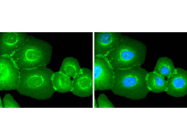 EGFR Antibody in Immunocytochemistry (ICC/IF)