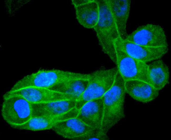 EGFR Antibody in Immunocytochemistry (ICC/IF)