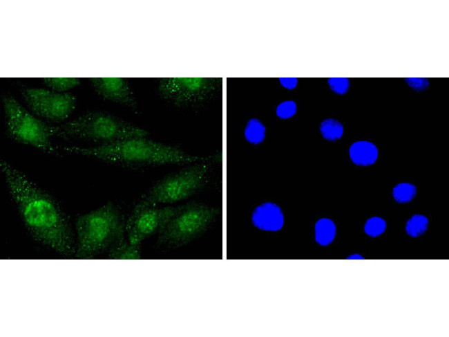 EGFR Antibody in Immunocytochemistry (ICC/IF)