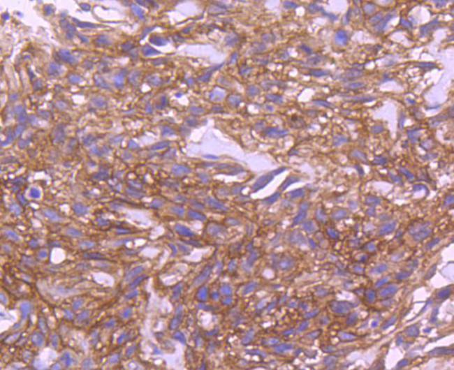 EGFR Antibody in Immunohistochemistry (Paraffin) (IHC (P))