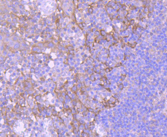 EGFR Antibody in Immunohistochemistry (Paraffin) (IHC (P))