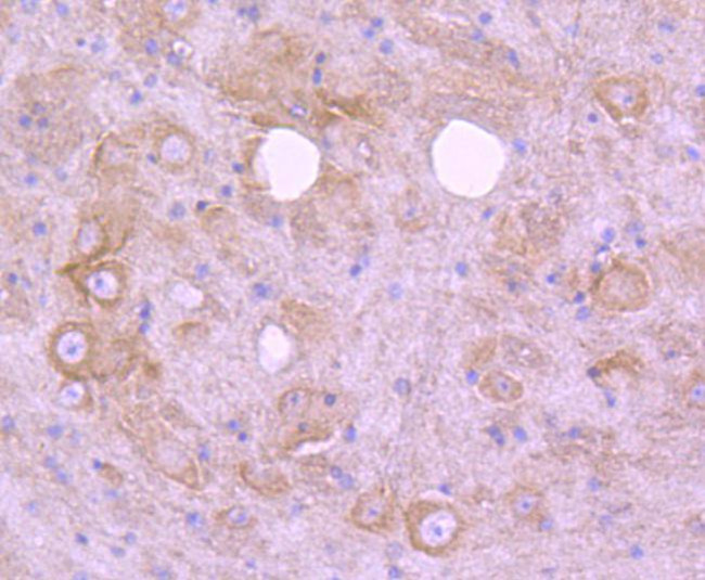 EGFR Antibody in Immunohistochemistry (Paraffin) (IHC (P))