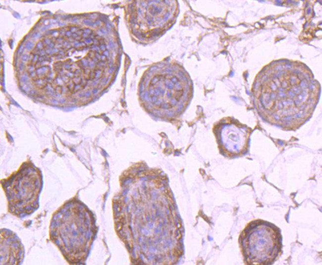 EGFR Antibody in Immunohistochemistry (Paraffin) (IHC (P))