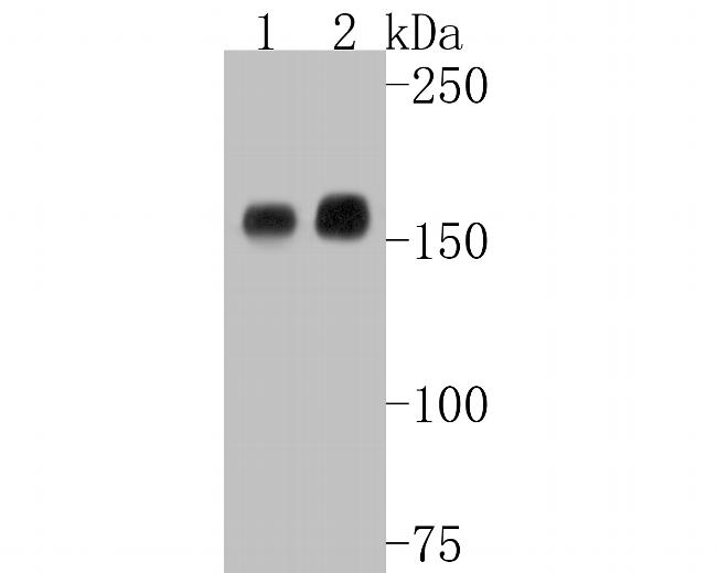 EGFR Antibody in Western Blot (WB)