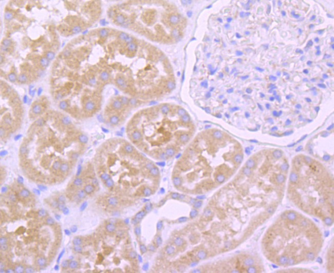 EGFR Antibody in Immunohistochemistry (Paraffin) (IHC (P))