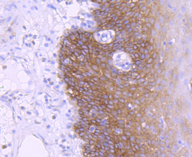 EGFR Antibody in Immunohistochemistry (Paraffin) (IHC (P))