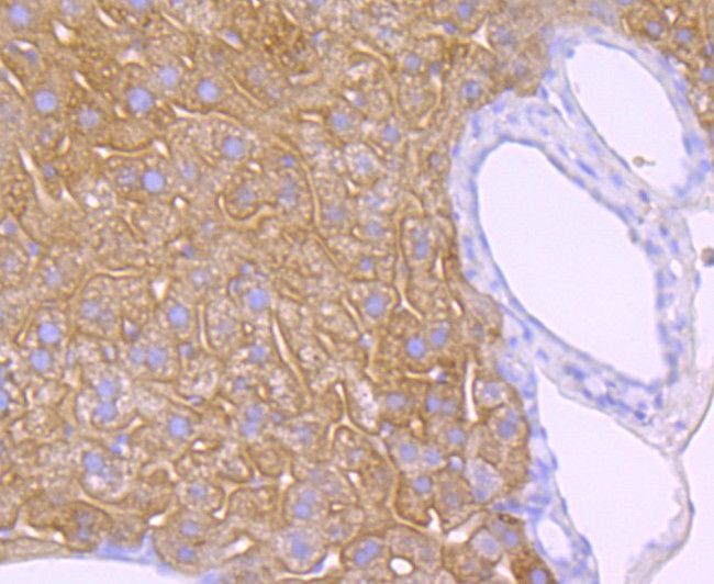 EGFR Antibody in Immunohistochemistry (Paraffin) (IHC (P))