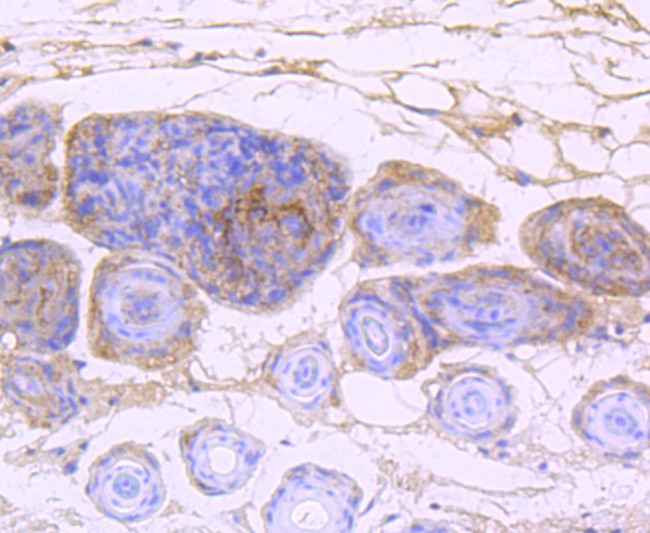 EGFR Antibody in Immunohistochemistry (Paraffin) (IHC (P))