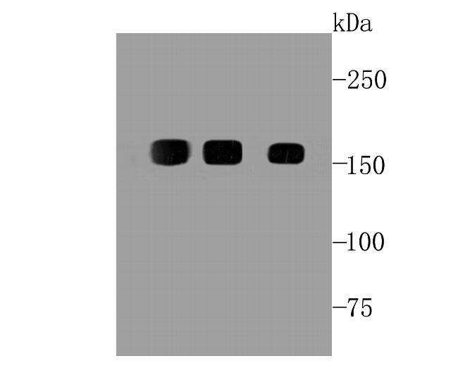 EGFR Antibody in Western Blot (WB)