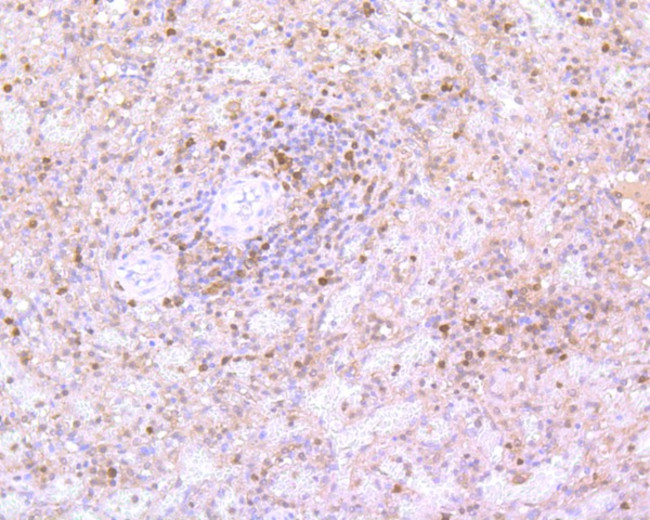 Caspase 3 Antibody in Immunohistochemistry (Paraffin) (IHC (P))