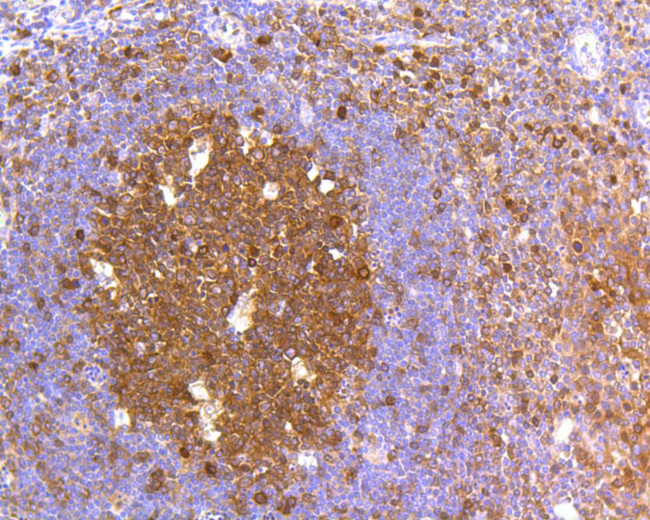 Caspase 3 Antibody in Immunohistochemistry (Paraffin) (IHC (P))