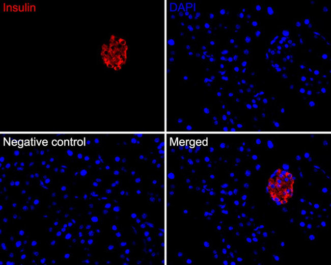 Insulin Antibody in Immunohistochemistry (Paraffin) (IHC (P))