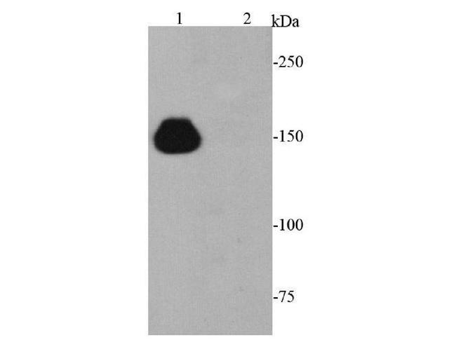 Cas9 Antibody in Western Blot (WB)