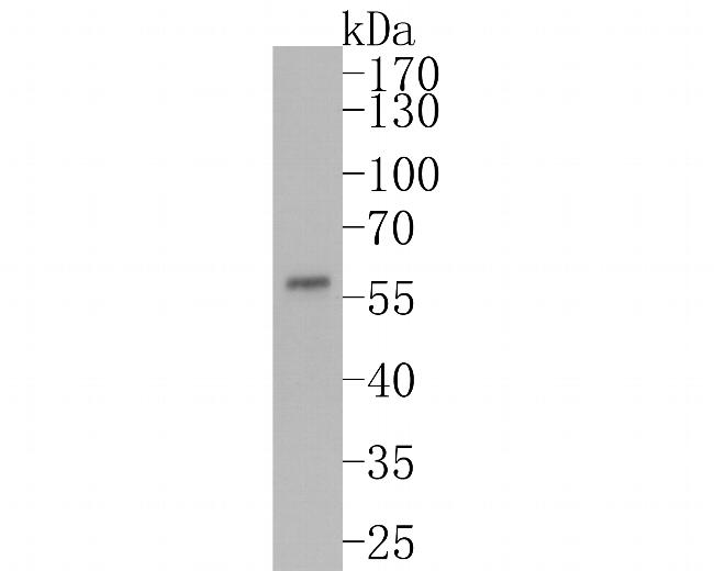 FOXA1 Antibody in Western Blot (WB)