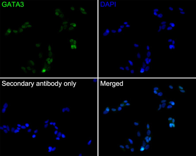 GATA3 Antibody in Immunocytochemistry (ICC/IF)