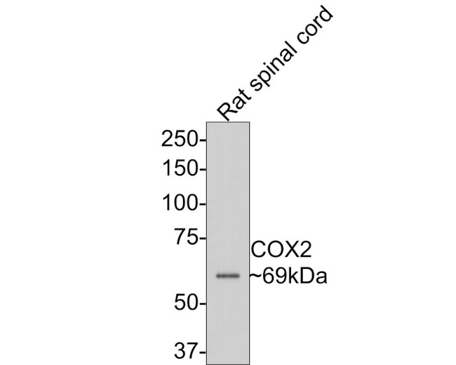 COX2 Antibody in Immunohistochemistry (Paraffin) (IHC (P))