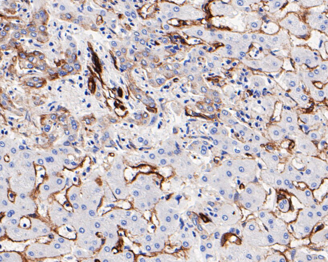 Caveolin 1 Antibody in Immunohistochemistry (Paraffin) (IHC (P))