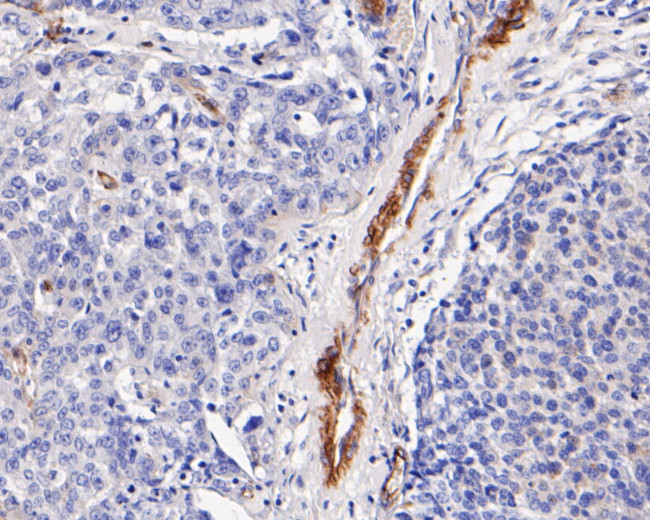 Caveolin 1 Antibody in Immunohistochemistry (Paraffin) (IHC (P))