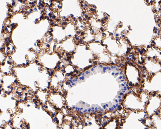 Caveolin 1 Antibody in Immunohistochemistry (Paraffin) (IHC (P))