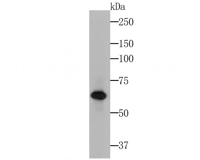 Cytokeratin 5/6 Antibody in Western Blot (WB)