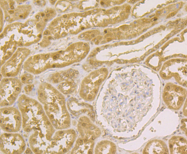 APE1 Antibody in Immunohistochemistry (Paraffin) (IHC (P))