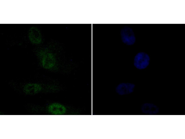 APE1 Antibody in Immunocytochemistry (ICC/IF)