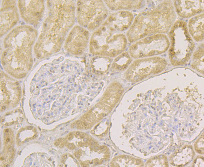 APE1 Antibody in Immunohistochemistry (Paraffin) (IHC (P))