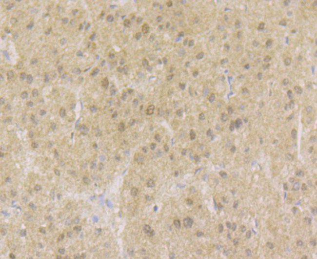 APE1 Antibody in Immunohistochemistry (Paraffin) (IHC (P))