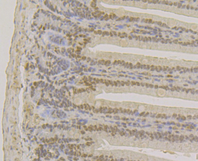 APE1 Antibody in Immunohistochemistry (Paraffin) (IHC (P))