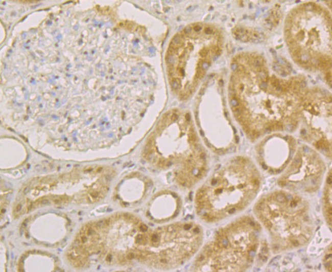 APE1 Antibody in Immunohistochemistry (Paraffin) (IHC (P))