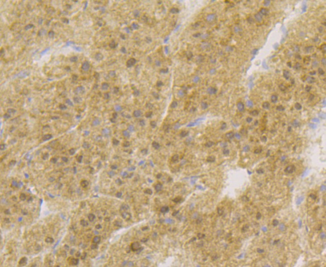 APE1 Antibody in Immunohistochemistry (Paraffin) (IHC (P))