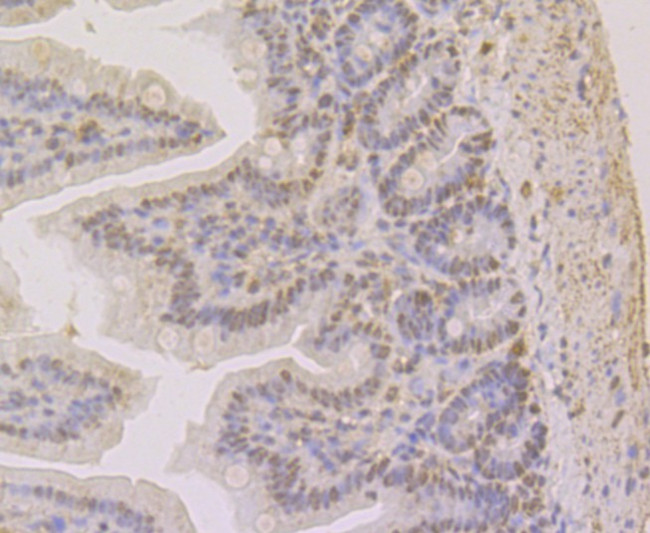 APE1 Antibody in Immunohistochemistry (Paraffin) (IHC (P))