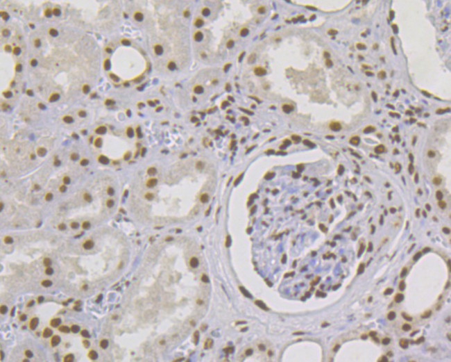 MSH2 Antibody in Immunohistochemistry (Paraffin) (IHC (P))