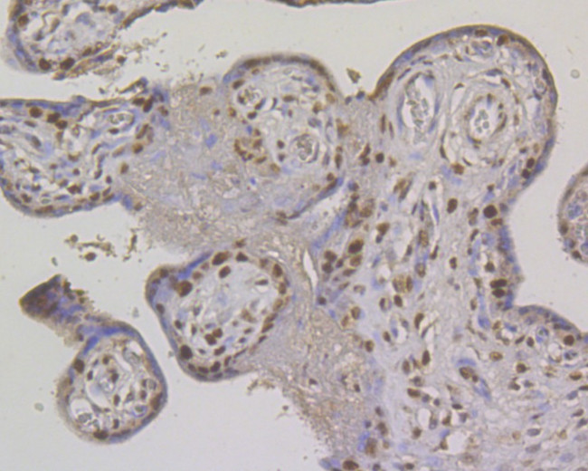 MSH2 Antibody in Immunohistochemistry (Paraffin) (IHC (P))