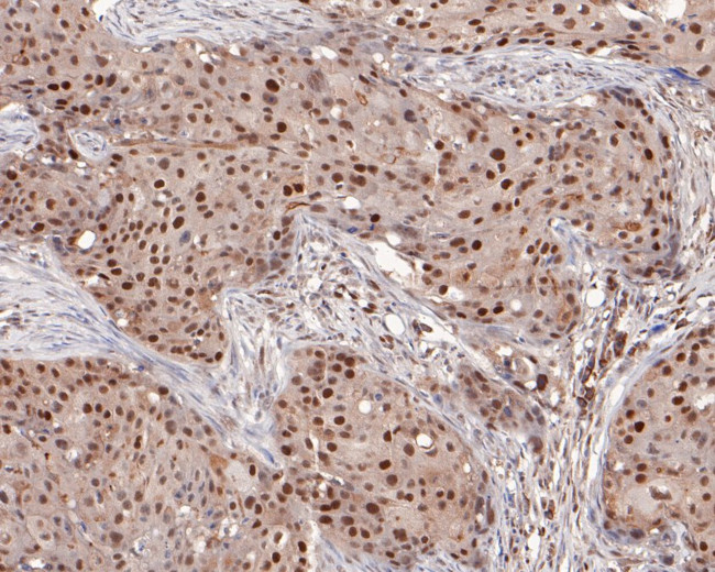 MSH2 Antibody in Immunohistochemistry (Paraffin) (IHC (P))